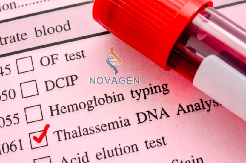 xét nghiệm Thalassemia bằng công nghệ ADN