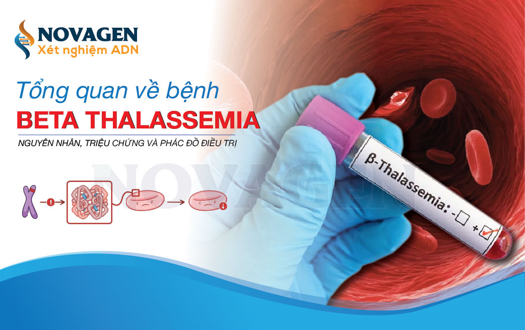 Tổng quan về bệnh Beta Thalassemia - Nguyên nhân, Triệu chứng và Phác đồ điều trị
