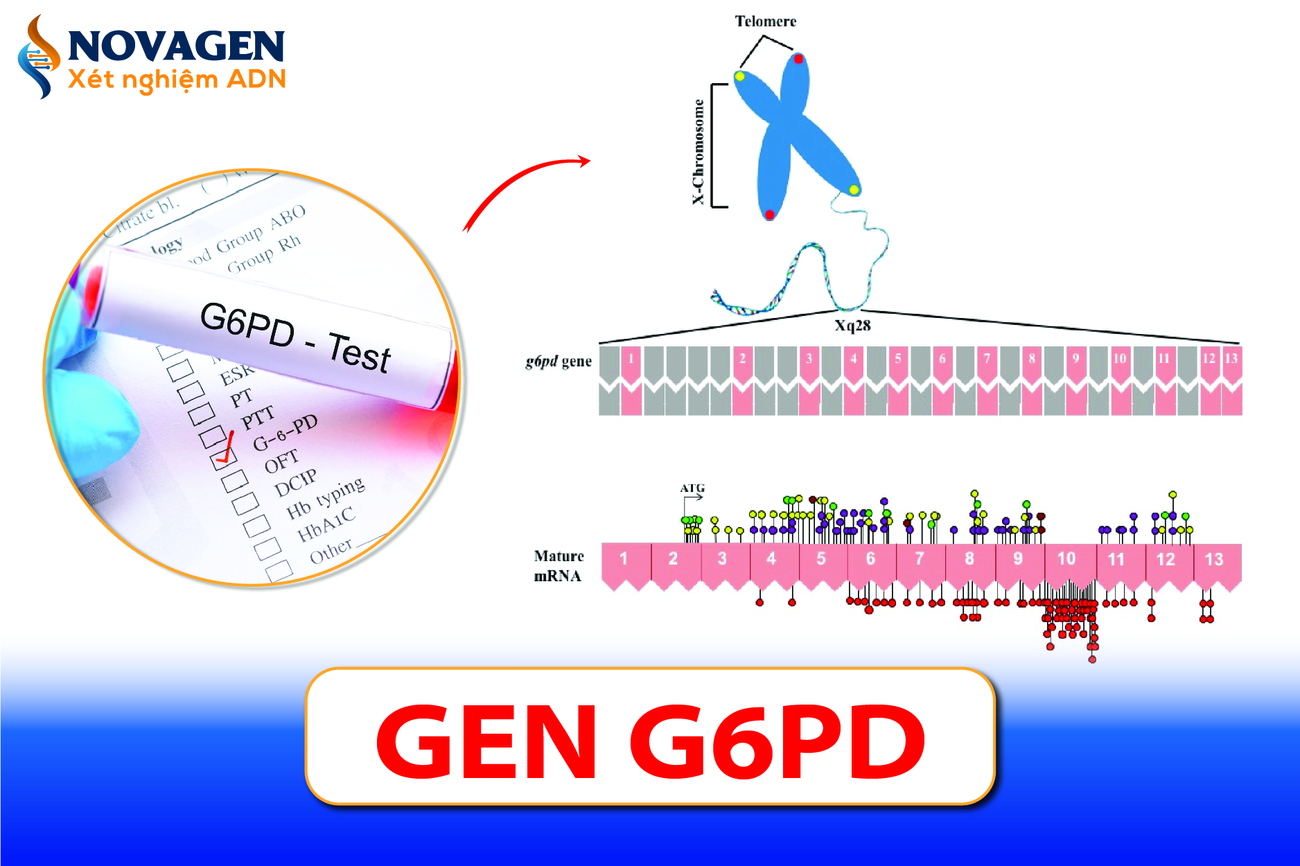 Gen G6PD