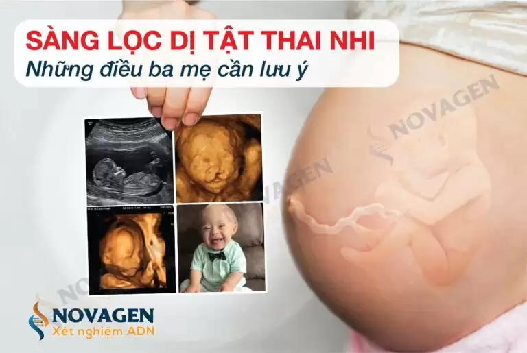 3 Lý Do Nên Sàng Lọc Dị Tật Thai Nhi