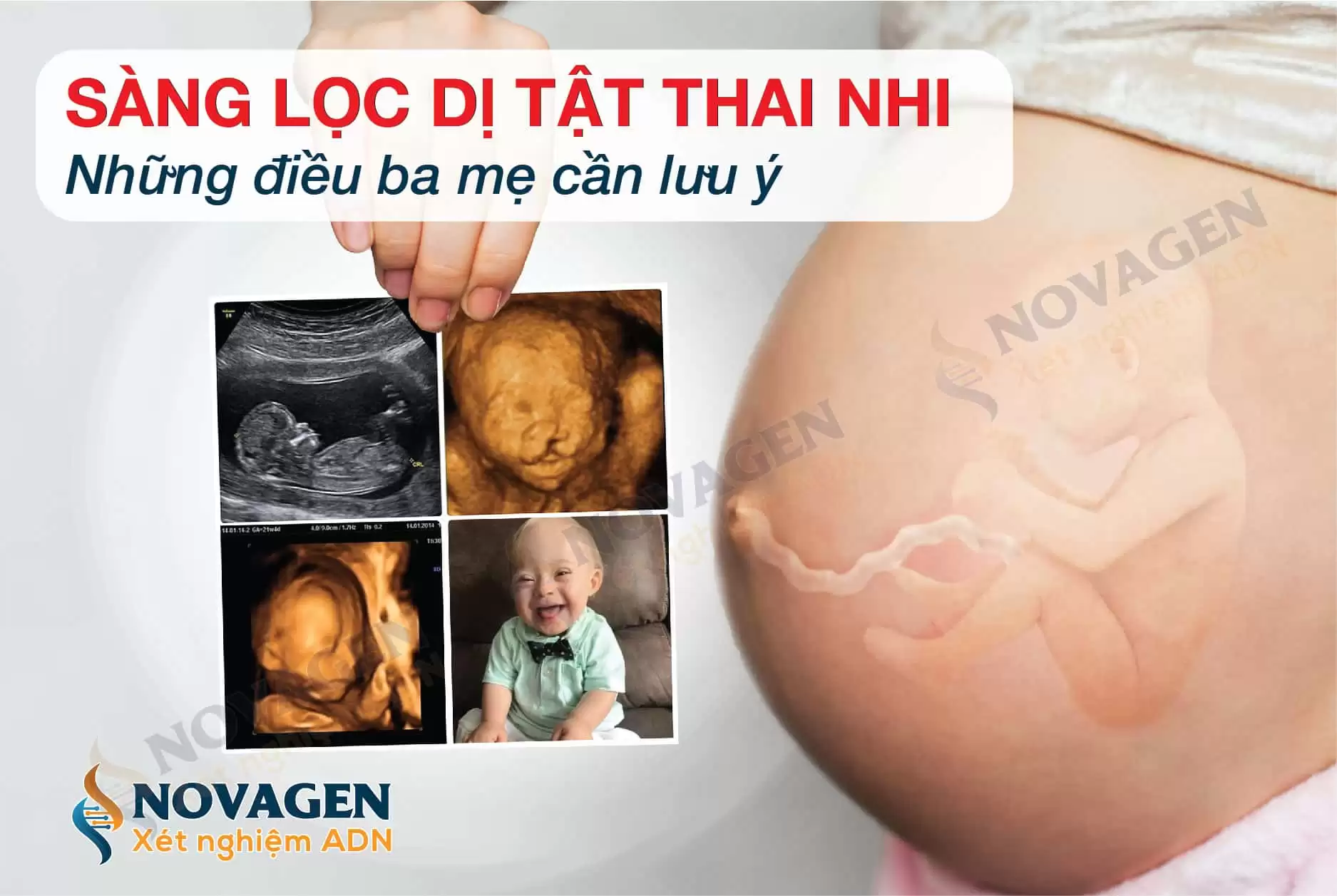 3 Lý Do Nên Sàng Lọc Dị Tật Thai Nhi