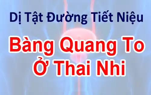 Dị Tật Bàng Quang To Ở Thai Nhi – Megacystis