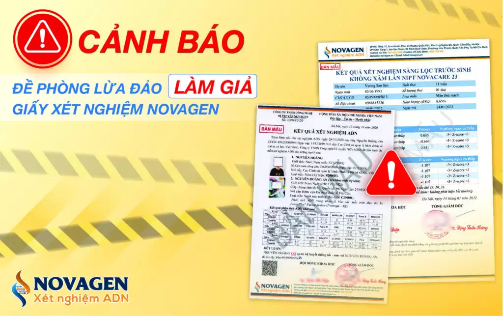 CẢNH BÁO: ĐỀ PHÒNG LỪA ĐẢO LÀM GIẢ GIẤY XÉT NGHIỆM NOVAGEN