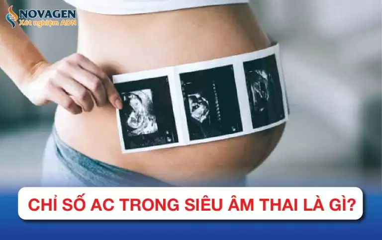 Chỉ Số AC Trong Siêu Âm Thai Là Gì?