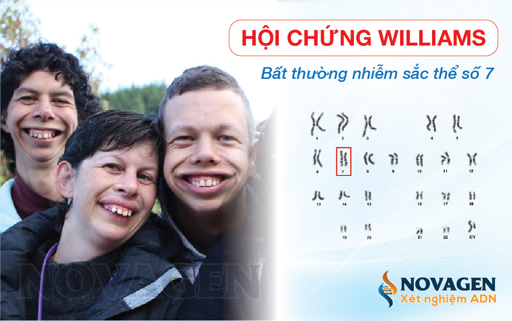 Hội Chứng Williams - Bất Thường Nhiễm Sắc Thể Số 7