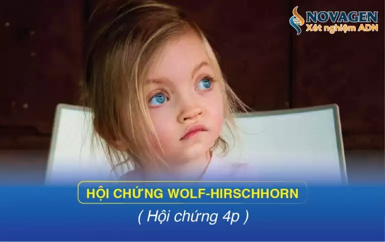 Hội Chứng Wolf-Hirschhorn (Hội Chứng 4p)