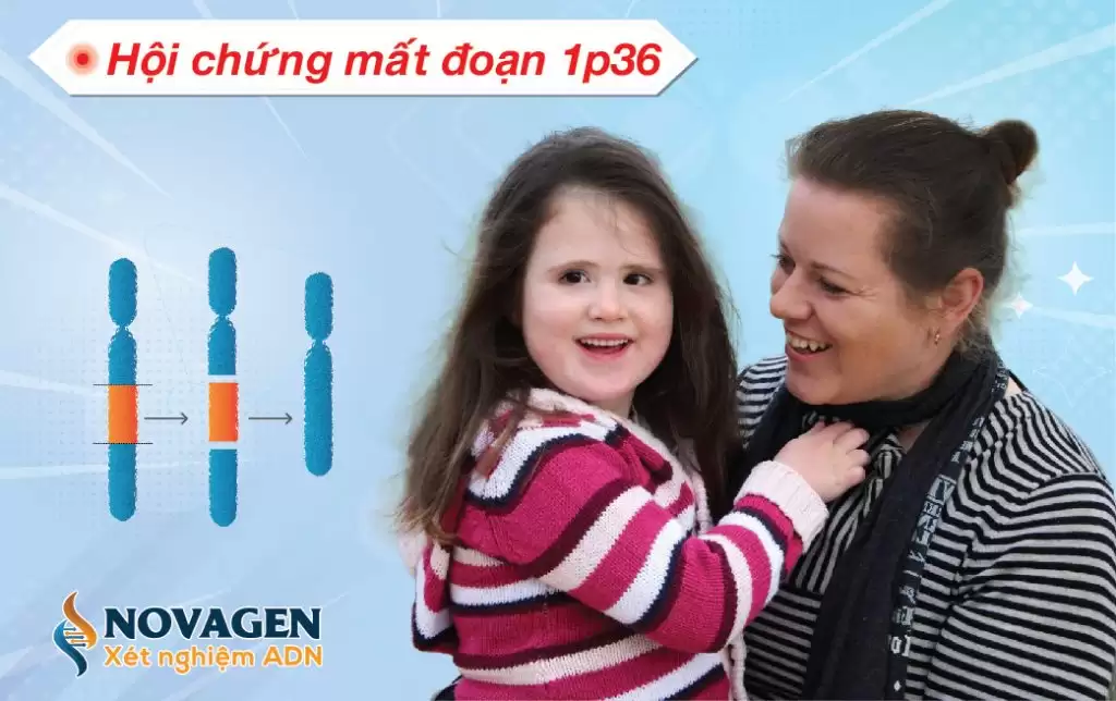 Hội Chứng Mất Đoạn 1p36 Là Gì?