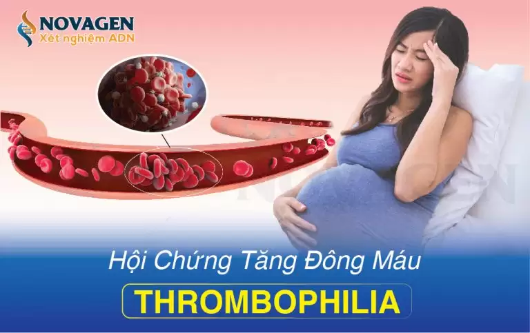 Hội Chứng Tăng Đông Máu Thrombophilia