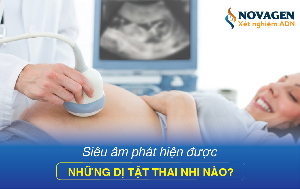 Siêu Âm Phát Hiện Được Những Dị Tật Thai Nhi Nào?