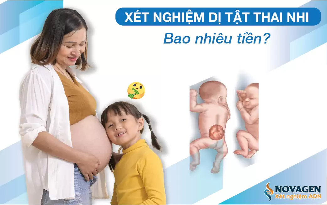 Xét Nghiệm Dị Tật Thai Nhi Bao Nhiêu Tiền?