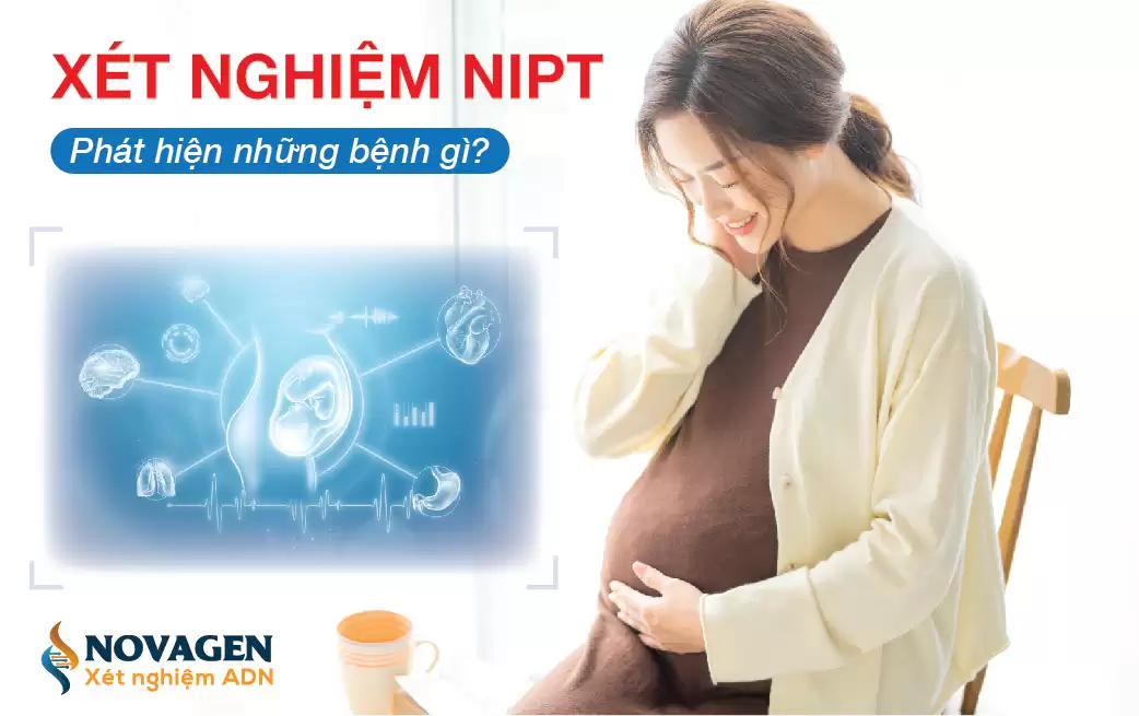 Xét Nghiệm NIPT Phát Hiện Những Bệnh Gì?