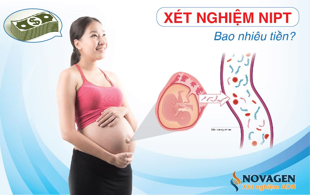 Xét nghiệm NIPT bao nhiêu tiền? Bảng giá xét nghiệm NIPT hiện nay