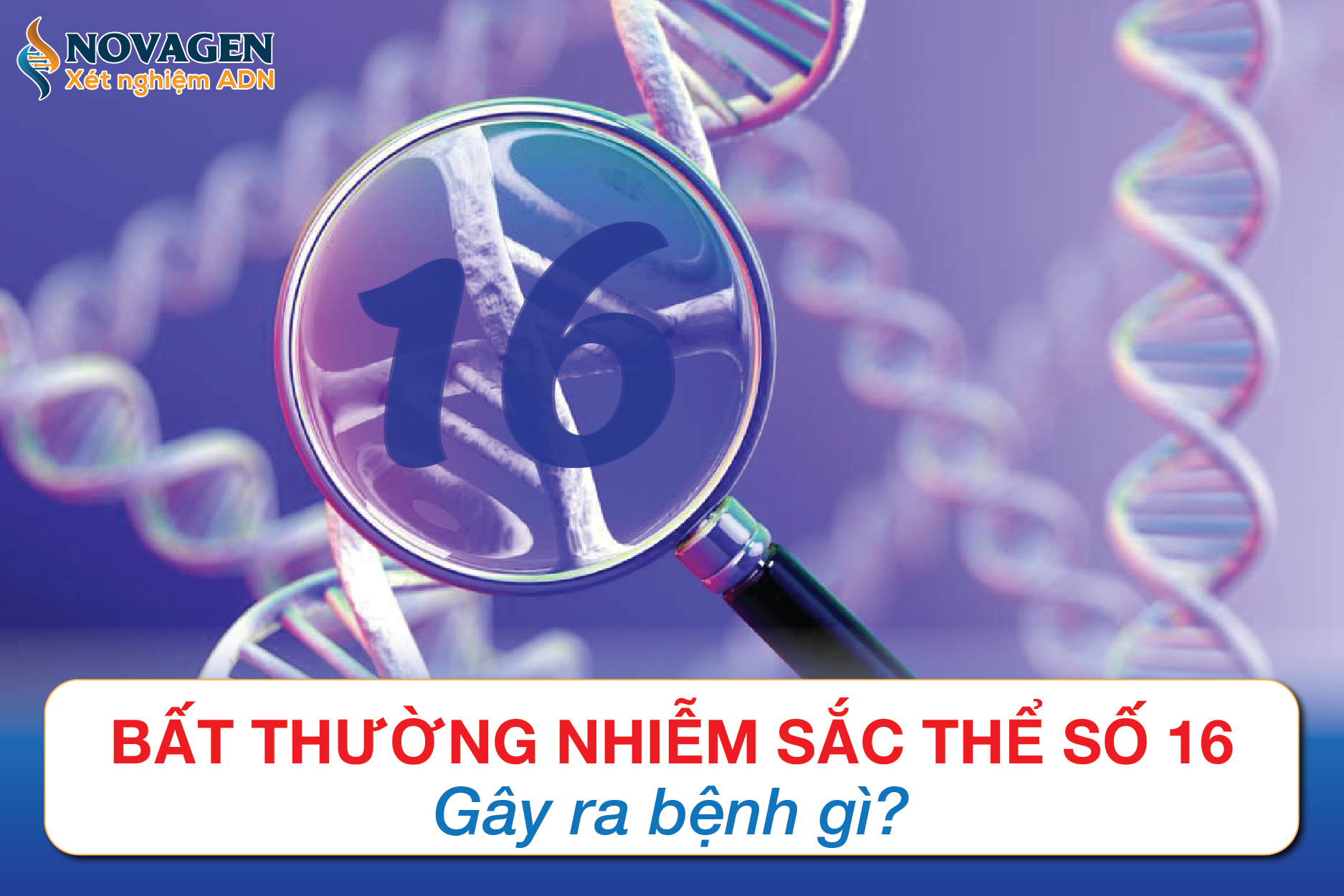 Bất Thường Nhiễm Sắc Thể Số 16 Gây Ra Bệnh Gì?