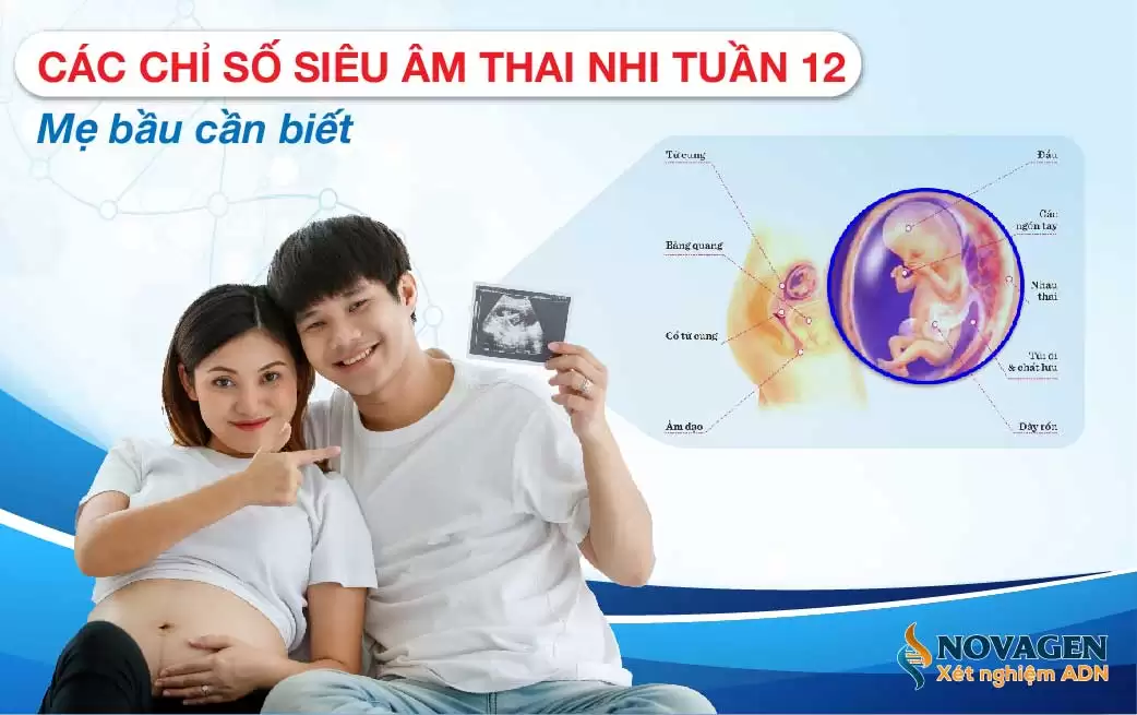 Các Chỉ Số Siêu Âm Tuần 12 Mẹ Bầu Cần Biết