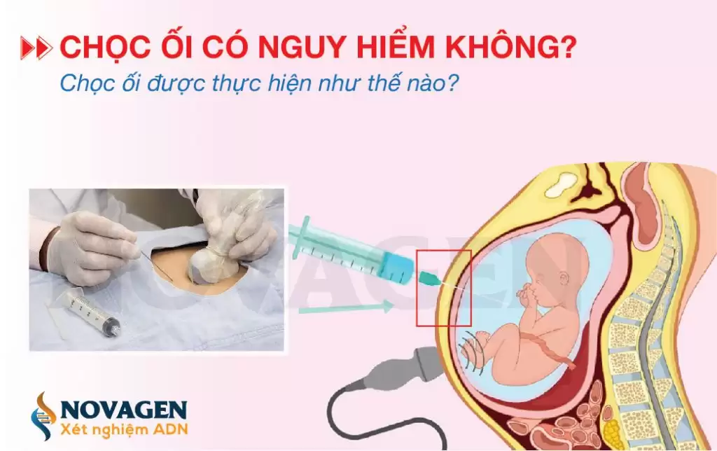 Chọc Ối Có Nguy Hiểm Không? Chọc Ối Được Thực Hiện Như Thế Nào?