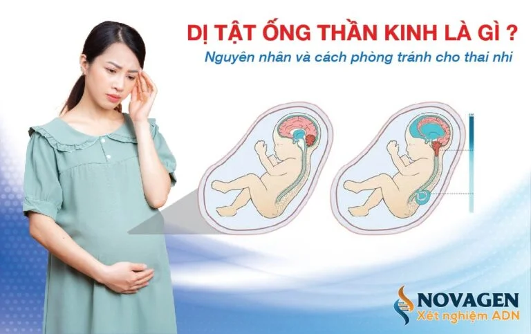 Dị Tật Ống Thần Kinh Là Gì? Tuần phát hiện và vai trò NIPT