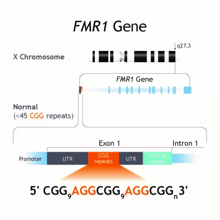 Gen FMR1 Gây Hội Chứng Fragile X