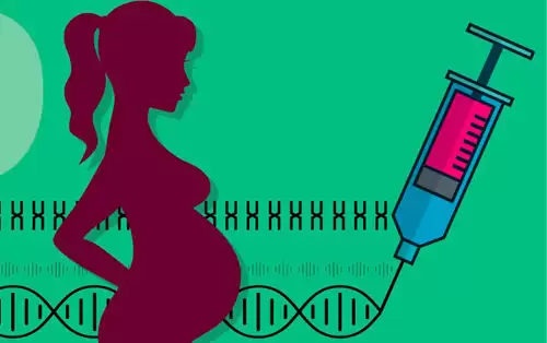 Hội Chứng Edwards - Trisomy 18 Hội Chứng Edwards - Trisomy 18