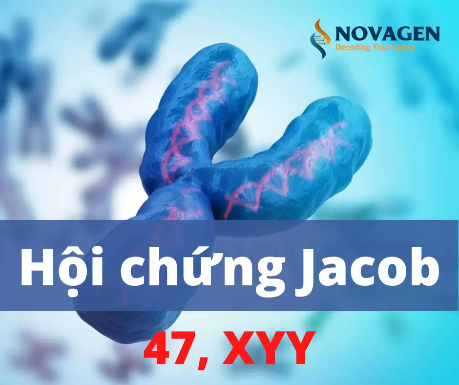 Hội Chứng Jacob (XYY)