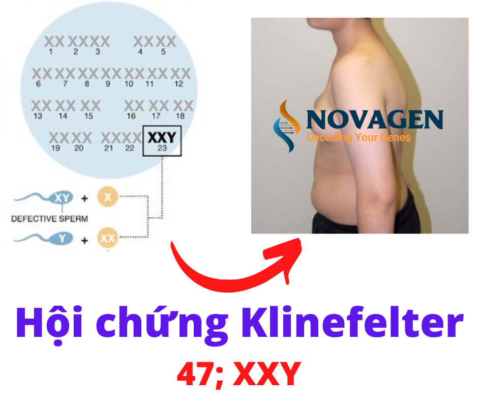 7. Những câu hỏi thường gặp về hội chứng XXY