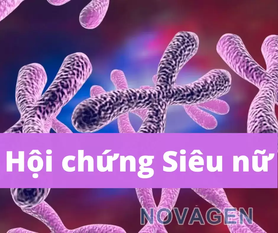 Hội Chứng Siêu Nữ (XXX) – Triple X