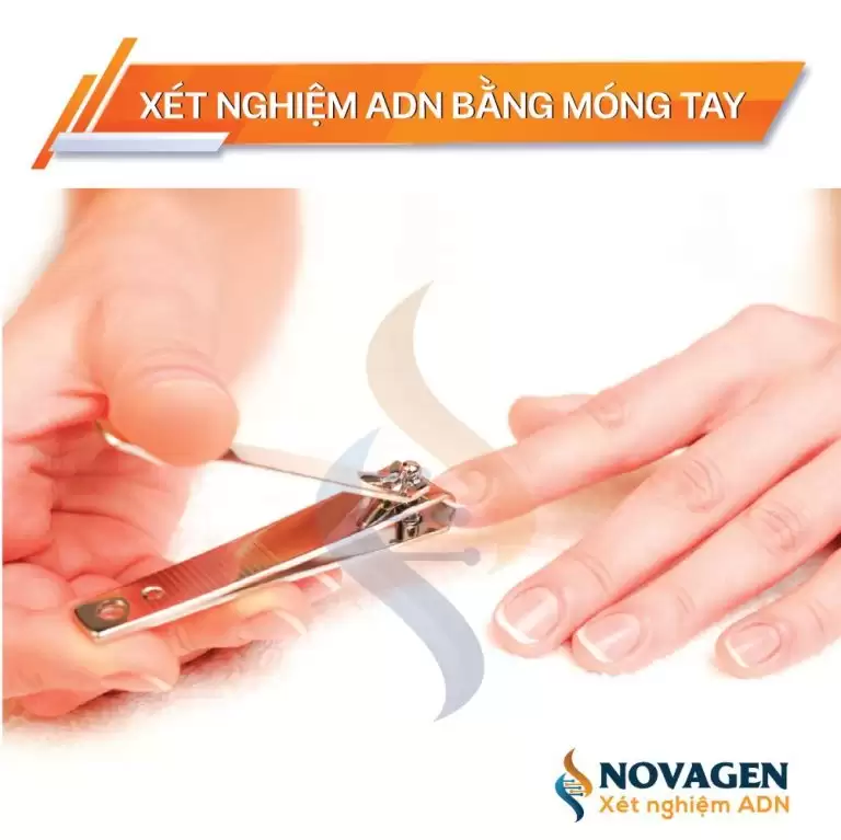 5 bước lấy mẫu móng tay làm xét nghiệm ADN ngay tại nhà