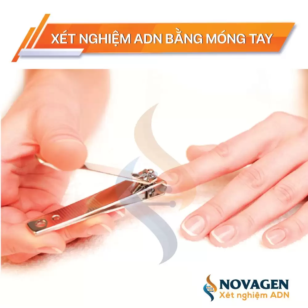 5 bước lấy mẫu móng tay làm xét nghiệm ADN ngay tại nhà