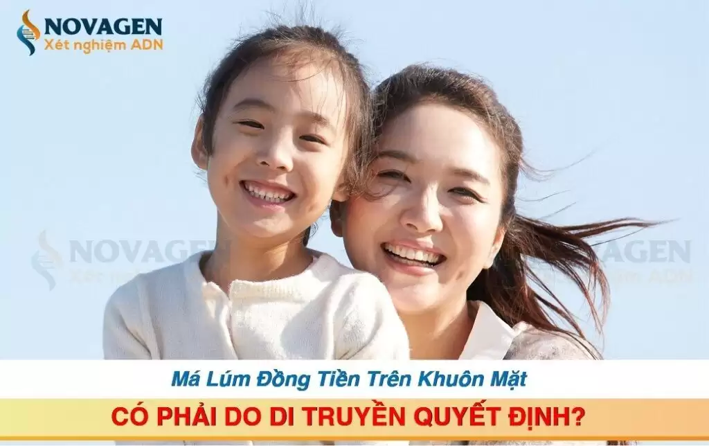 Má Lúm Đồng Tiền Trên Khuôn Mặt Có Phải Do Di Truyền Quyết Định?