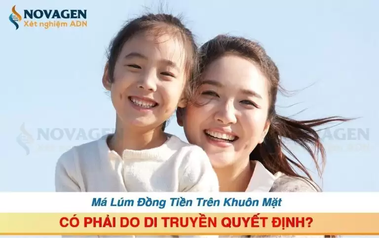 Má Lúm Đồng Tiền Trên Khuôn Mặt Có Phải Do Di Truyền Quyết Định?