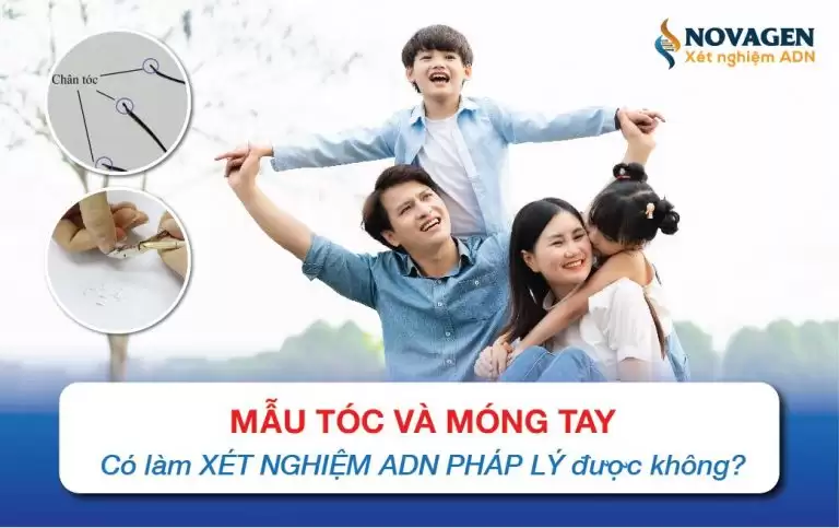 Mẫu Tóc Và Móng Tay Có Xét Nghiệm ADN Pháp Lý Được Không?