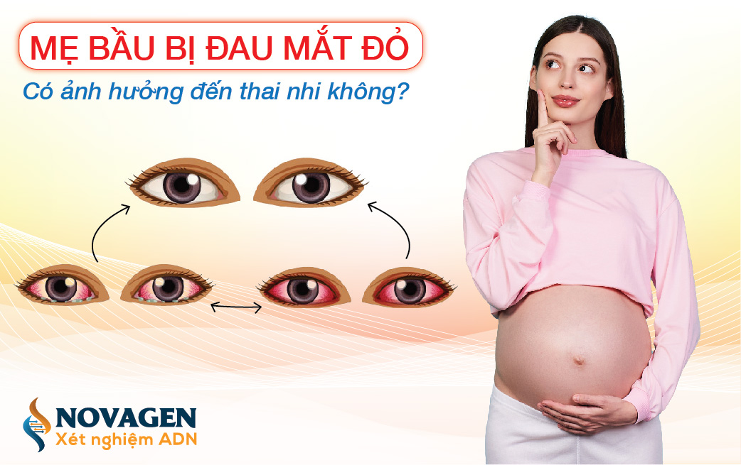 Mẹ Bầu Bị Đau Mắt Đỏ Có Ảnh Hưởng Đến Thai Nhi Không?