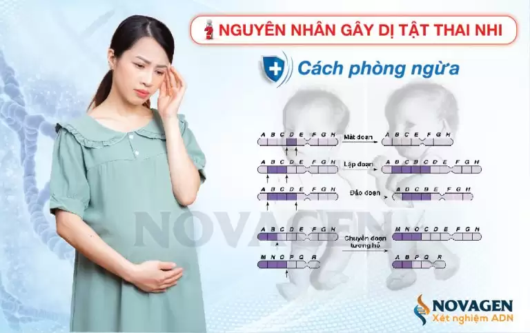 10 Nguyên Nhân Gây Dị Tật Thai Nhi Và Cách Phòng Ngừa
