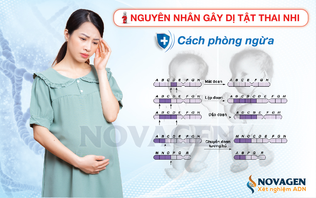 10 Nguyên Nhân Gây Dị Tật Thai Nhi Và Cách Phòng Ngừa