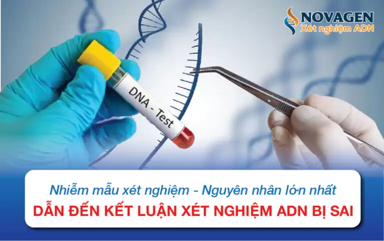 Nhiễm Mẫu Xét Nghiệm – Nguyên Nhân Lớn Nhất Dẫn Đến Kết Quả Xét Nghiệm ADN Bị Sai