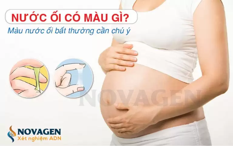 Nước Ối Có Màu Gì? Màu Nước Ối Bất Thường Cần Chú Ý
