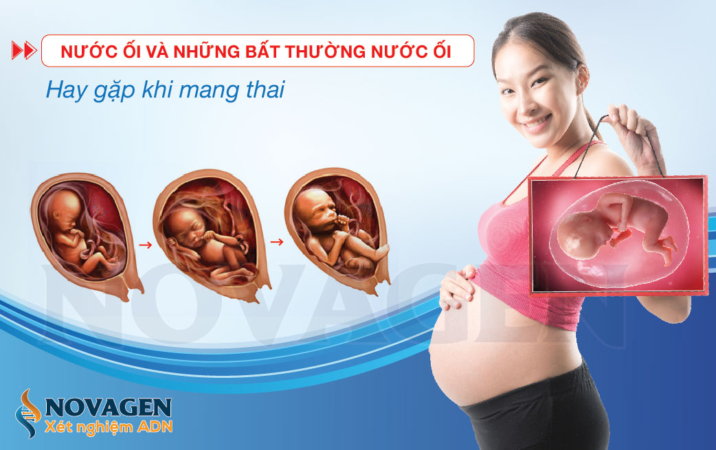 Nước Ối Và Những Bất Thường Nước Ối Hay Gặp Khi Mang Thai