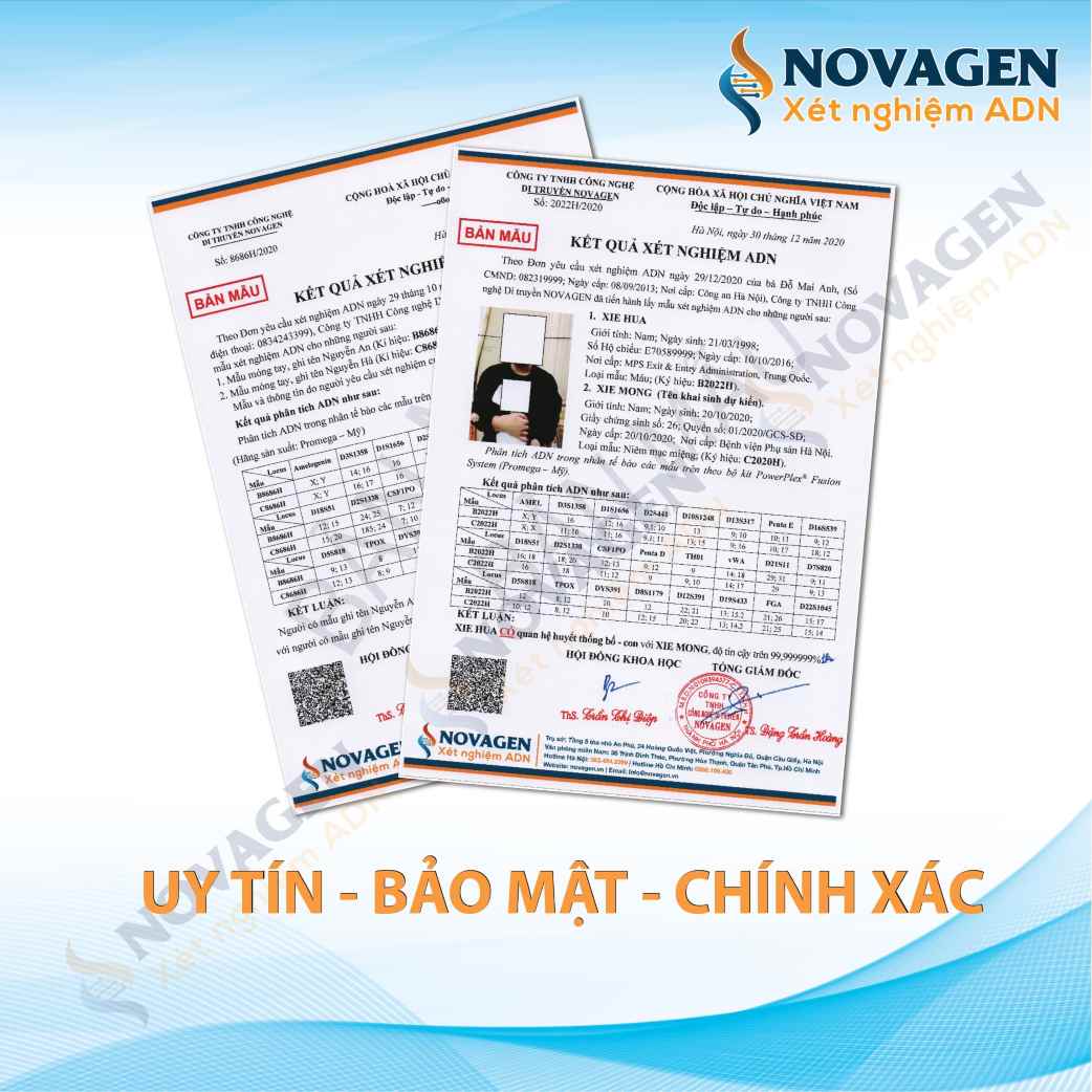 Mẫu kết quả xét nghiệm ADN tại NOVAGEN