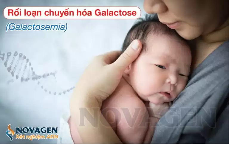 Rối Loạn Chuyển Hóa Galactose (Galactosemia)