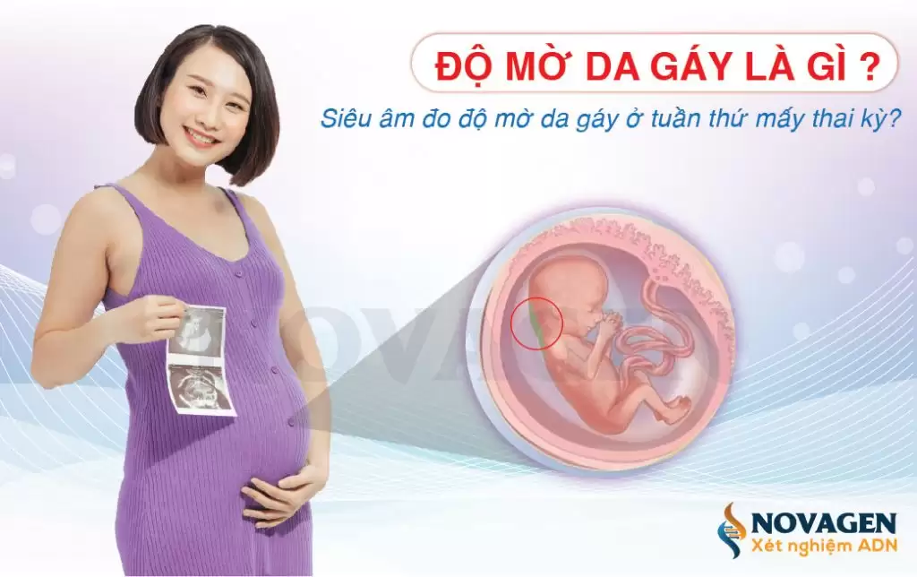 Độ Mờ Da Gáy Là Gì? Siêu Âm Đo Độ Mờ Da Gáy Ở Tuần Thứ Mấy Thai Kỳ?