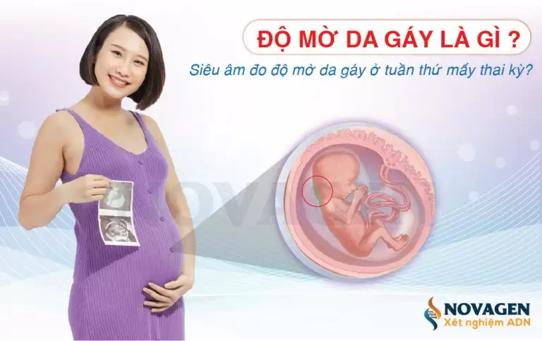 Độ Mờ Da Gáy Là Gì? Siêu Âm Đo Độ Mờ Da Gáy Ở Tuần Thứ Mấy Thai Kỳ?