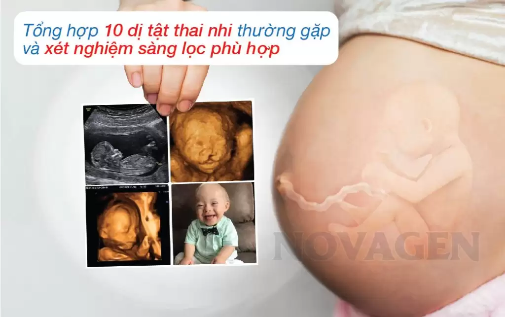 Tổng Hợp 10 Dị Tật Thai Nhi Thường Gặp Và Xét Nghiệm Sàng Lọc Phù Hợp