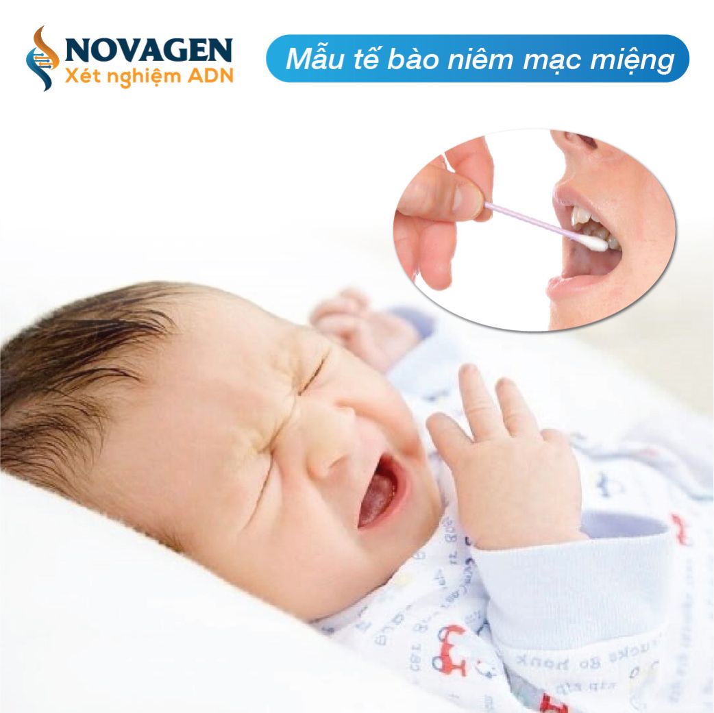 Thu mẫu tế bào niêm mạc miệng để xét nghiệm ADN cho trẻ sơ sinh