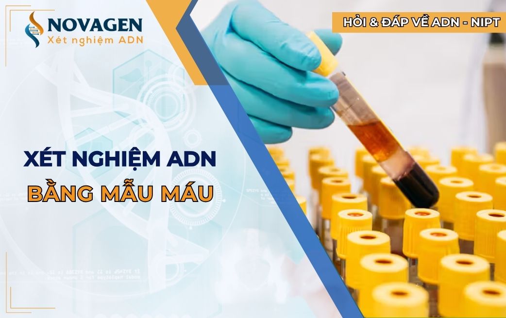 Xét nghiệm ADN bằng mẫu máu: 9+ điều quan trọng cần biết! 