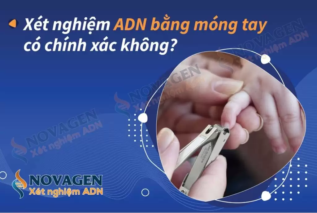 Xét nghiệm ADN bằng móng tay: Tổng hợp 9+ điều cần biết