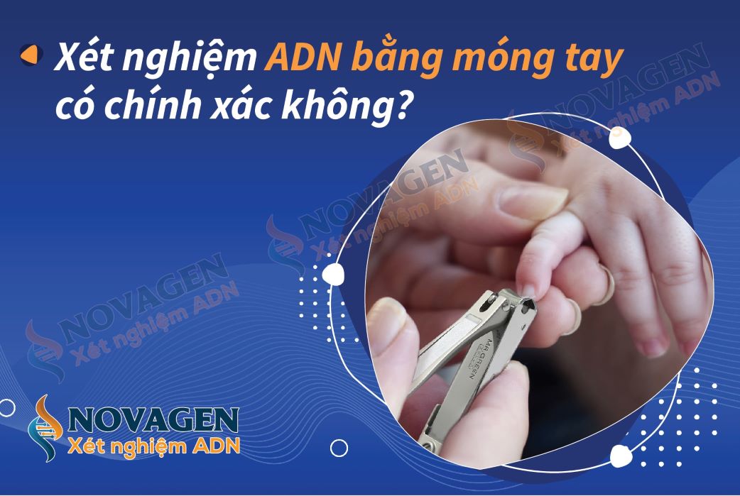 Xét nghiệm ADN bằng móng tay: Những điều cần biết