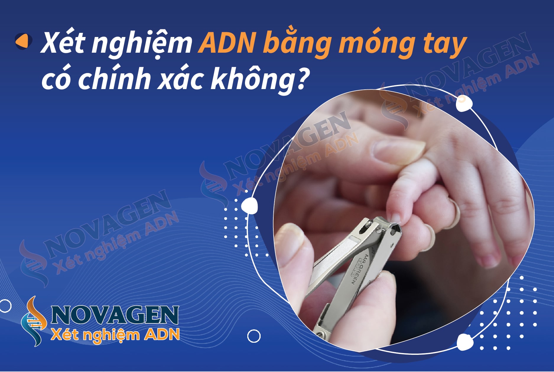 Xét nghiệm ADN bằng móng tay có chính xác không? Tìm hiểu ngay!