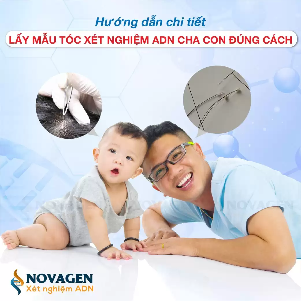 Xét Nghiệm ADN Bằng Tóc Bao Nhiêu Tiền