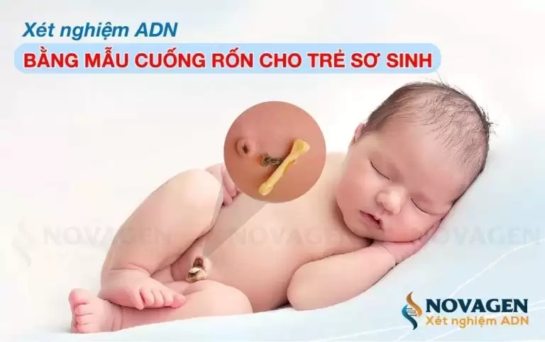 Xét nghiệm ADN bằng cuống rốn trẻ sơ sinh: 8+ điều quan trọng cần biết