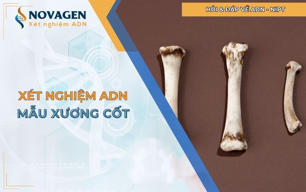 Xét nghiệm ADN mẫu xương cốt: Tất cả những điều bạn cần biết