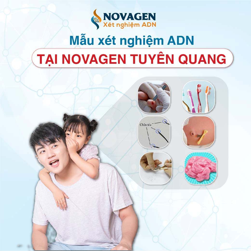 Mẫu xét nghiệm ADN tại NOVAGEN Tuyên Quang